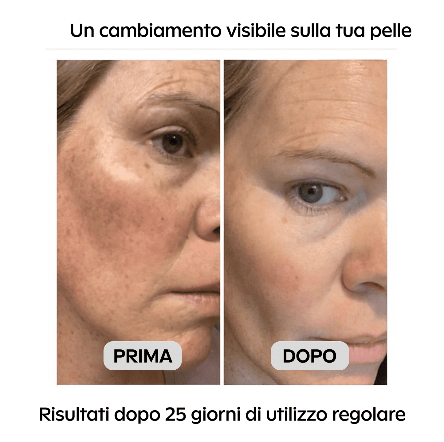 Siero al Niacinamide