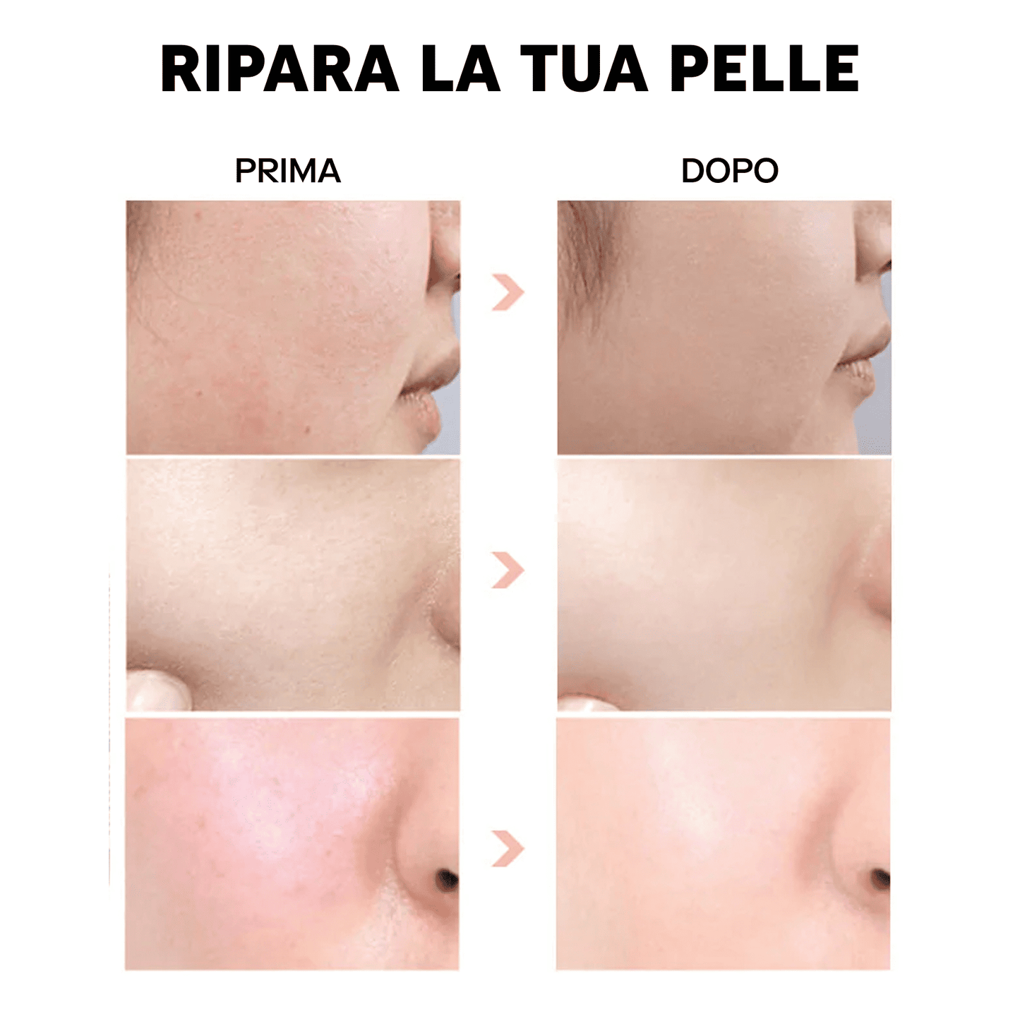 Siero all'Acido Ialuronico