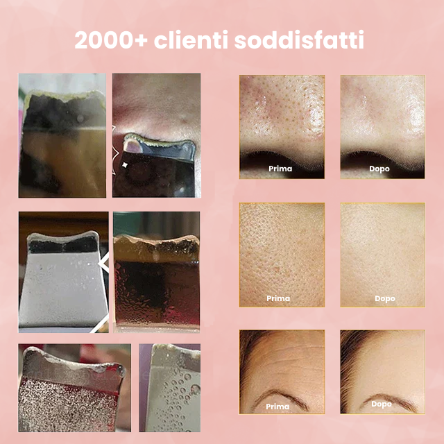 Scrub Facciale e Ultrasuoni Aurealface™