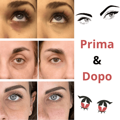 Trattamento Occhi Aurealface™