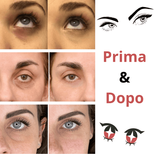 Trattamento Occhi Aurealface™