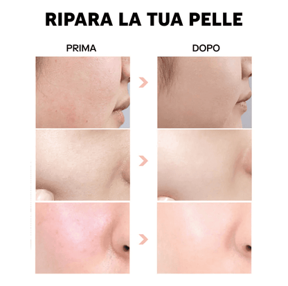 Siero all'Acido Ialuronico